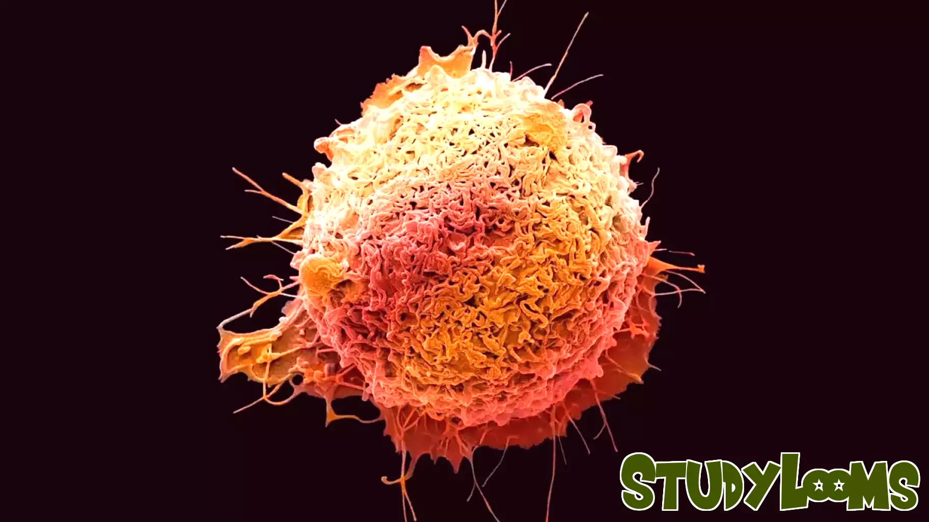 As Colorectal Cancer Rises in Younger Populations, Research and Education is More Important than Ever